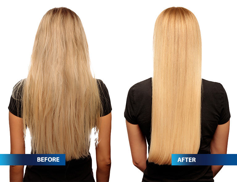 BEFORE AND AFTER HAIR CRYOTHERAPY